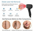 FAC Titanium Diode Laser Hair Removal Machine Soprano Ice Advanced 5000W 755nm、808nm、830nm、940nm、1064nm Professional Face Body